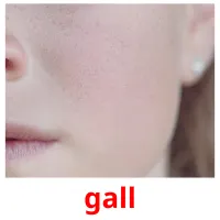 gall picture flashcards